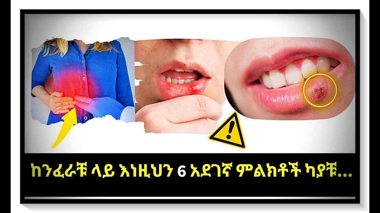 ከንፈራቹ ስለ ጤናቹ እየሰጣቹ ያሉ 6 የማስጠንቀቂያ ምልክቶች😱