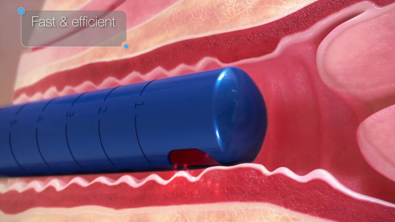 FemTouch   For Improved Vaginal Health - arcadis.mg