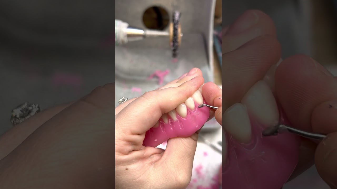 Carving and festooning maxillary set up