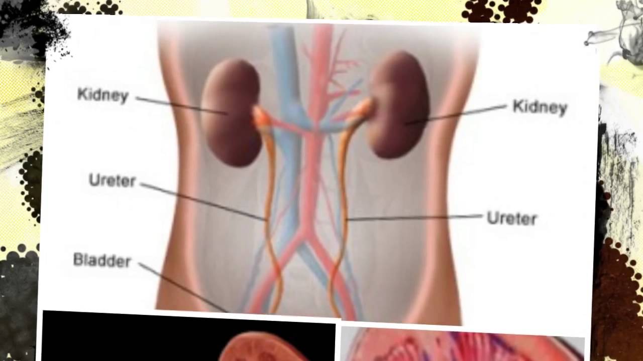 renal calculi treatment