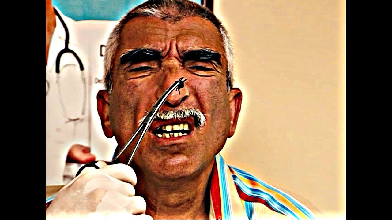 Akasya Durağı - Usman Aga'yı Kocaman Bir Kene Isırdı