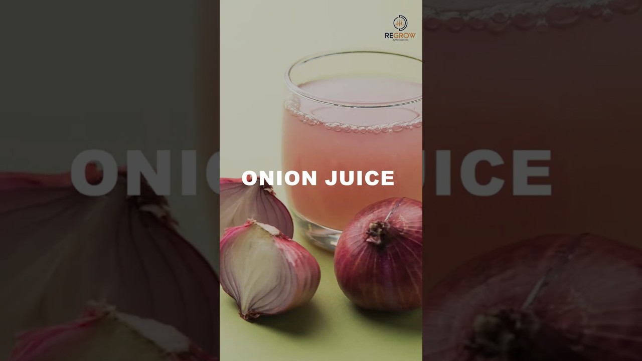 Onion Oil/Juice for Hair Growth: Does It Really Work? #drprateeksondhi #shorts