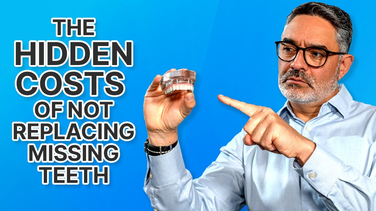 Missing Teeth and Facial Collapse: Why Implants Matter More Than You Think!