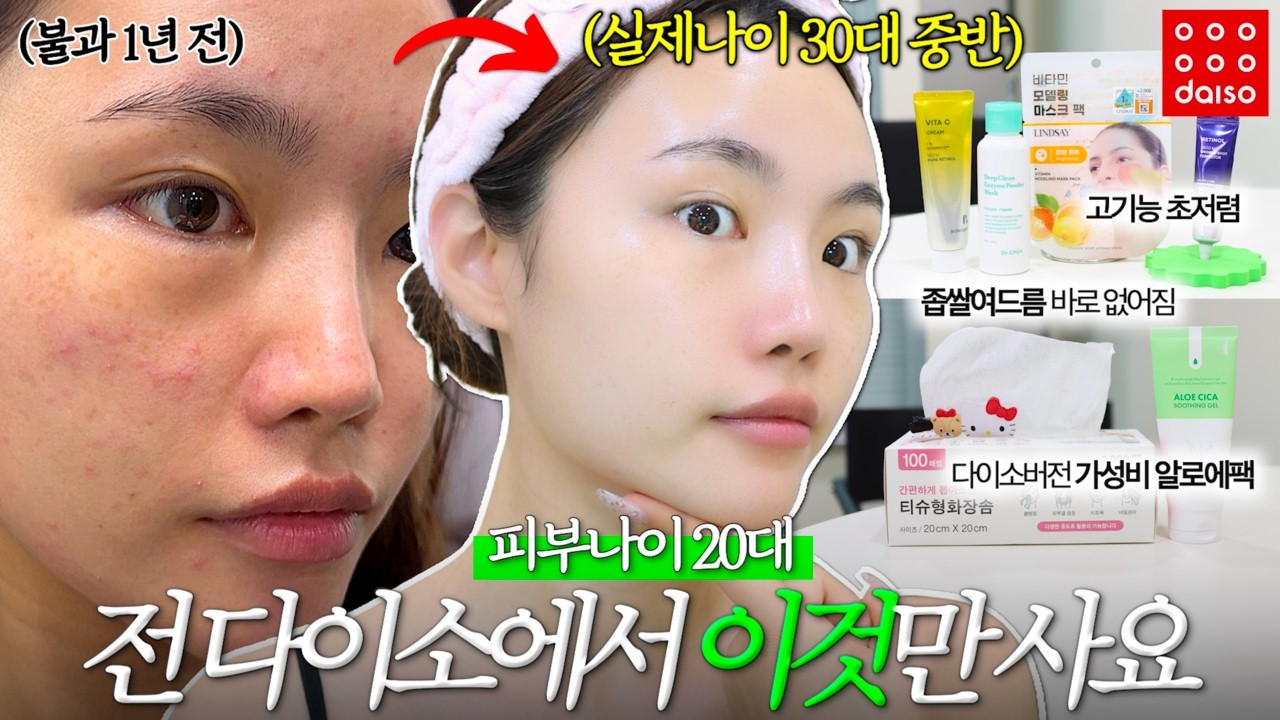 피부과 필수관리 다이소템으로 저렴하게 하는 법 알려드릴게요