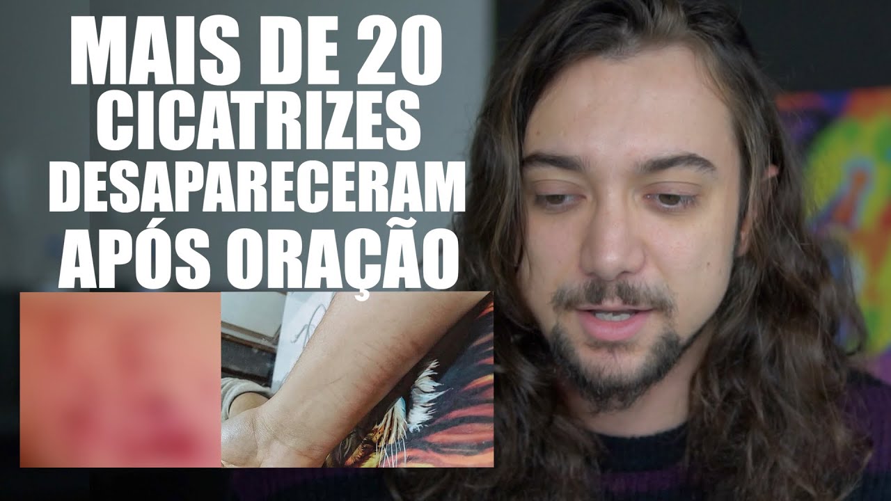 ELA TINHA CORTES NO CORPO TODO E OLHA O QUE JESUS FEZ