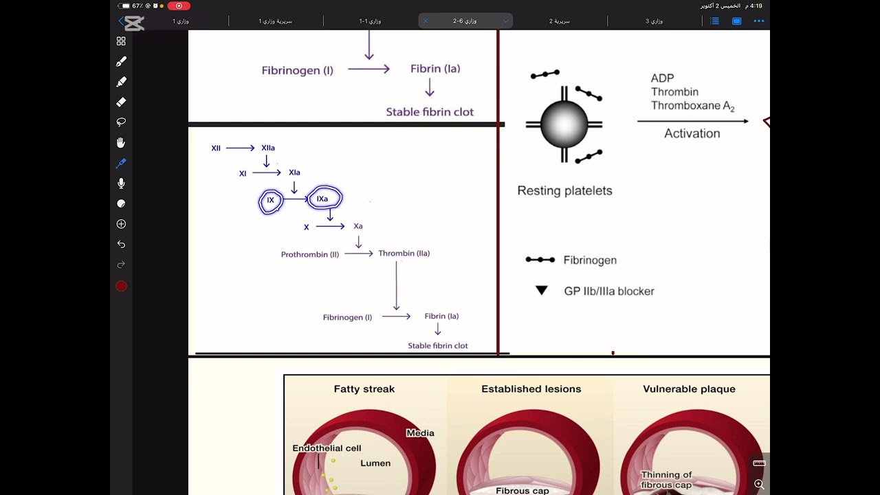  علاجيات ـ كورس اول ـ خامس صيدلة Acute coronary syndram  
