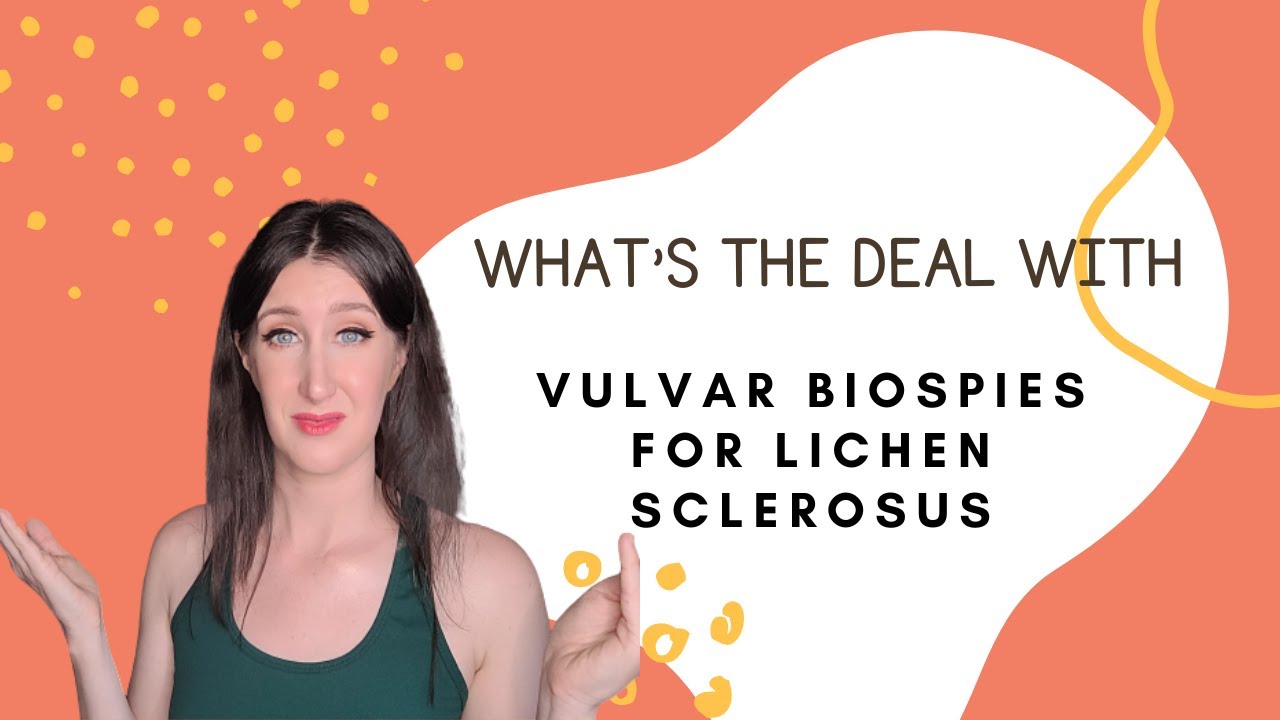 Lichen Sclerosus and Biopsies: What You Need To Know