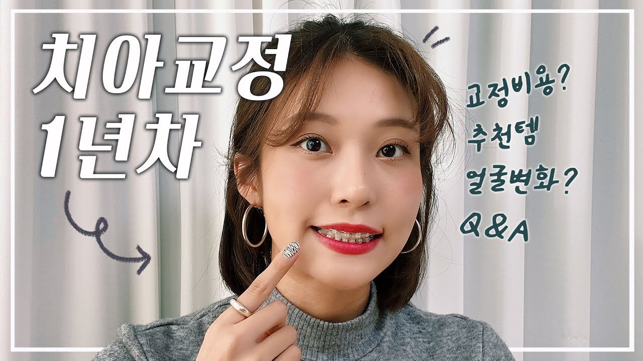 ⛓ 치아교정 1년차 : 교정 비용 공개💵 전후사진? 얼굴변화? 미리 알았다면 더 좋았을 것들 + Q&A