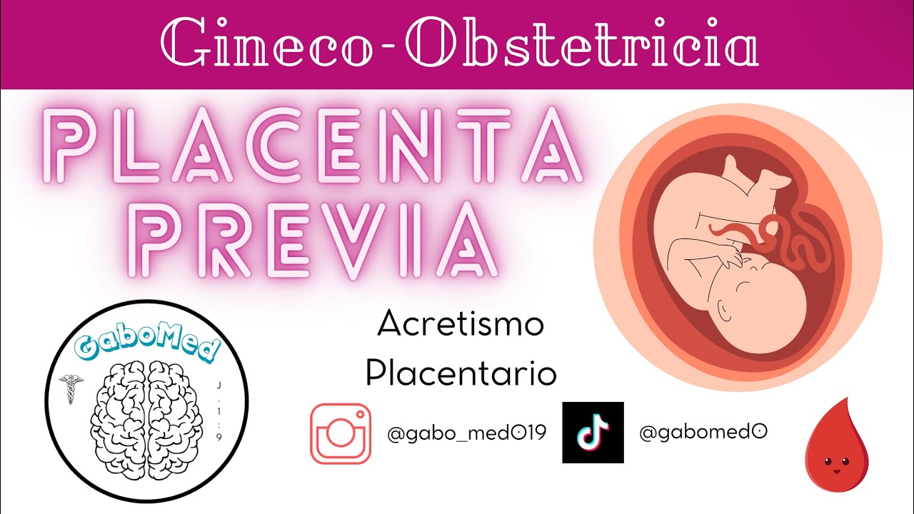 Placenta Previa Y Acretismo Placentario
