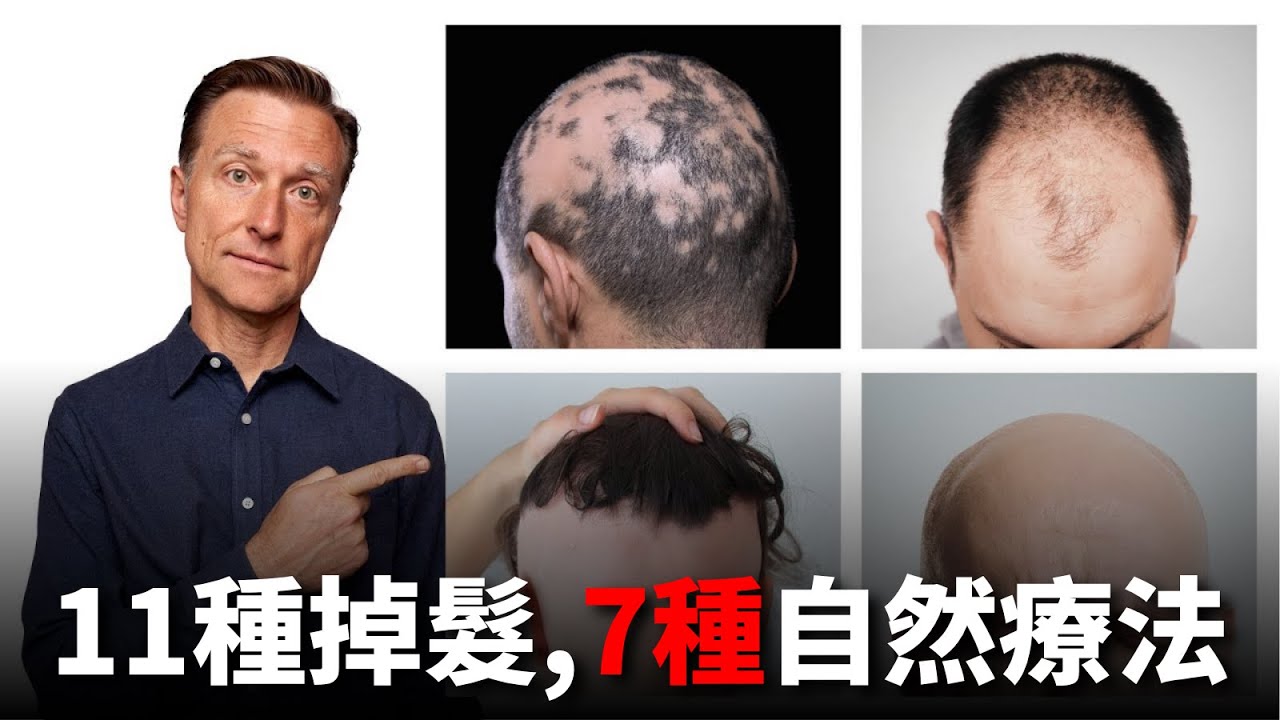 你正在掉髮嗎？可能是這11種之一｜7個自然療法對症下藥