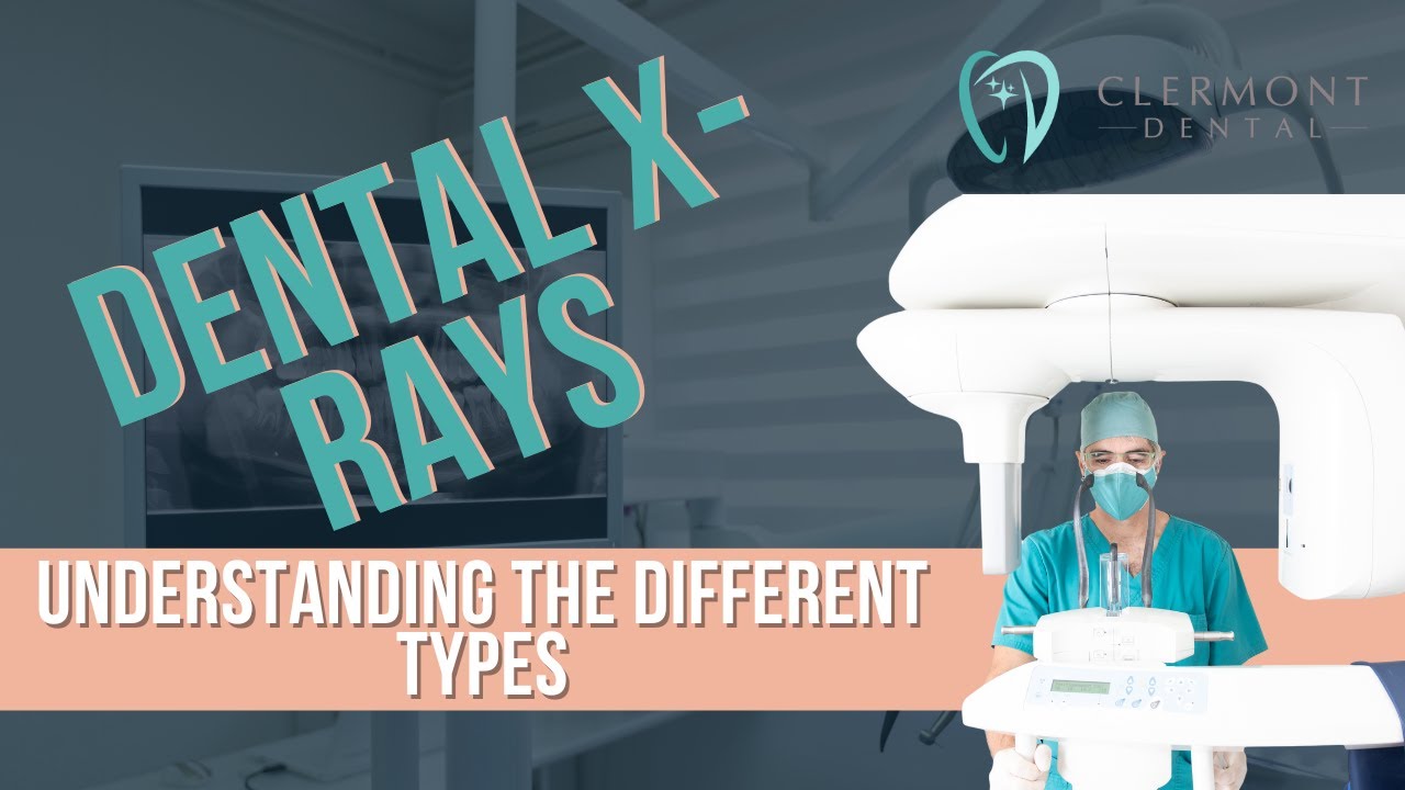Dental X rays: Understanding The Different Types #DentalCareDenver #ClermontDental #DentalXrays