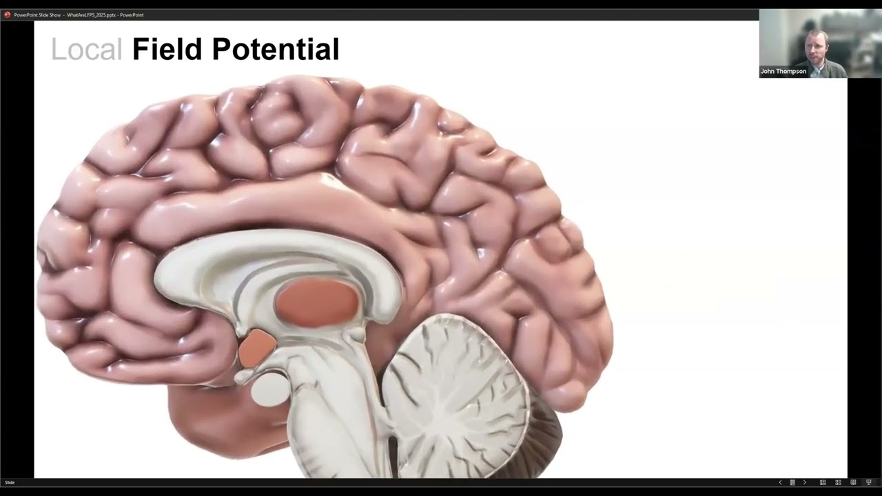What is DBS?: What are Local Field Potentials and Why Are They Important?
