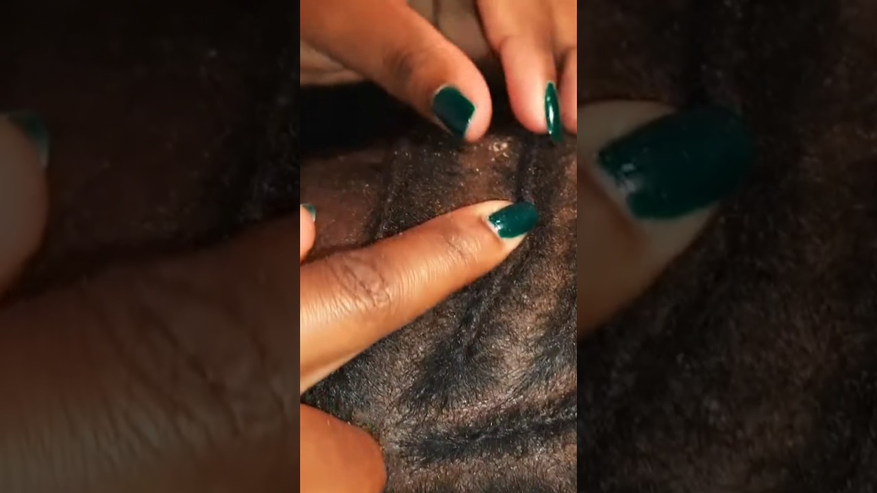 Asmr pure bliss ~ scalp scratching with blowing sounds #asmr #relaxing