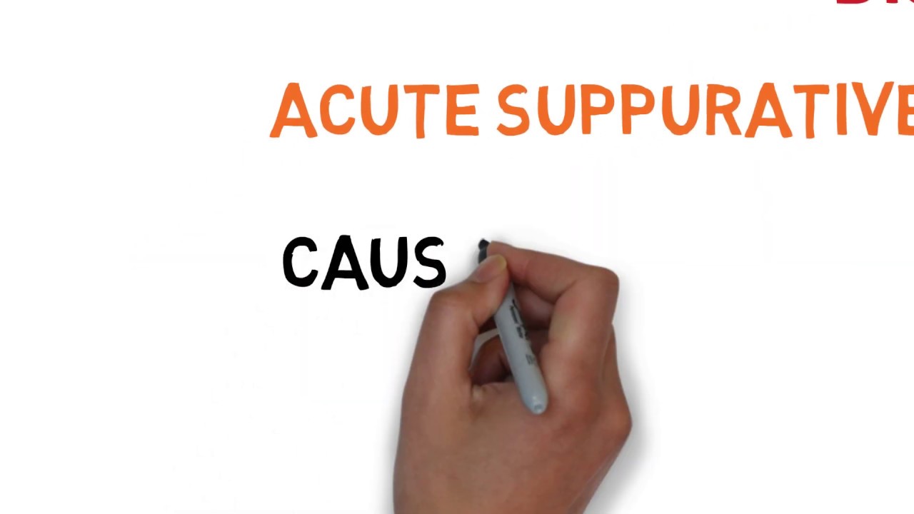 ACUTE SUPPURATIVE  OTITIS MEDIA (ASOM) lecture