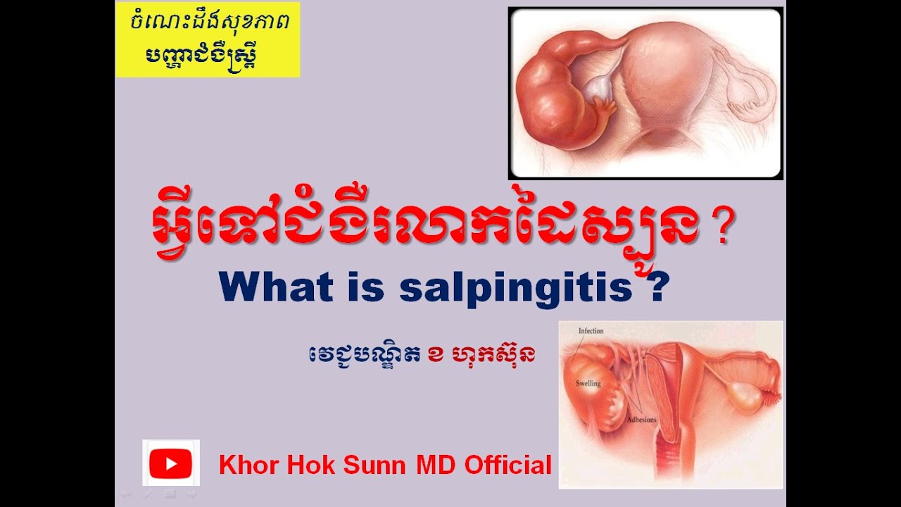 អ្វីទៅជំងឺរលាកដៃស្បូន?/What is salpingitis? l Khor Hok Sunn MD Official