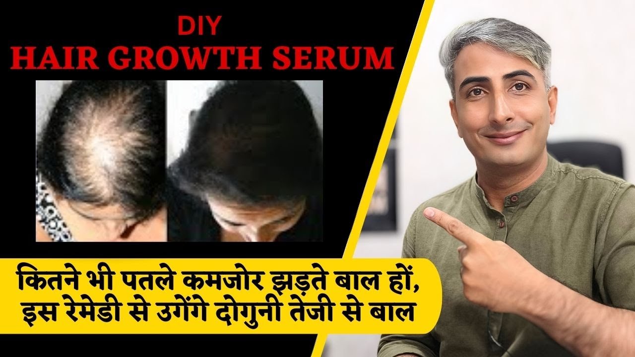 घर पर हल्के बालों को करें घना बनाइये। DIY Thick Hair Growth Serum I DR, MANOJ DAS