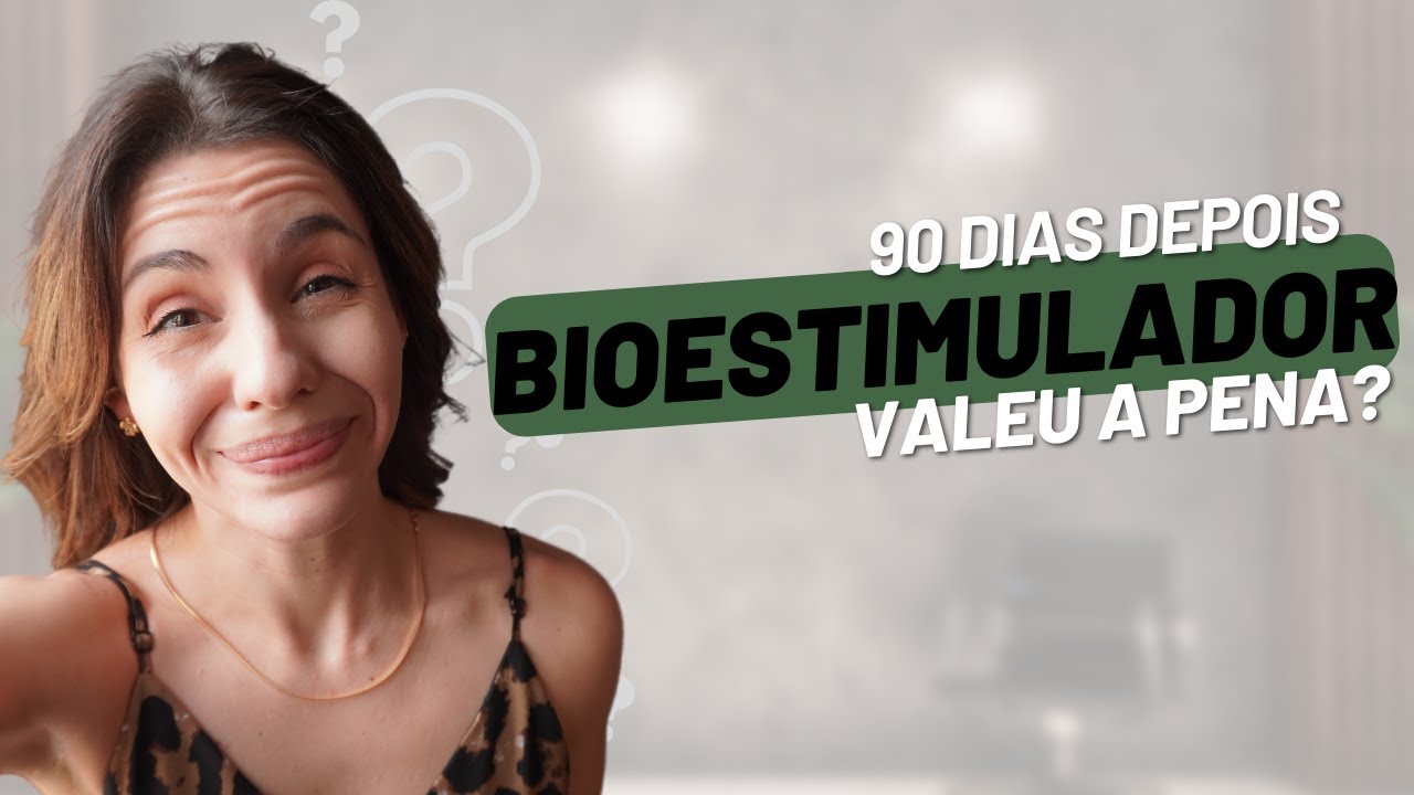 90 dias após o BIOESTIMULADOR de COLÁGENO. Como eu fiquei?