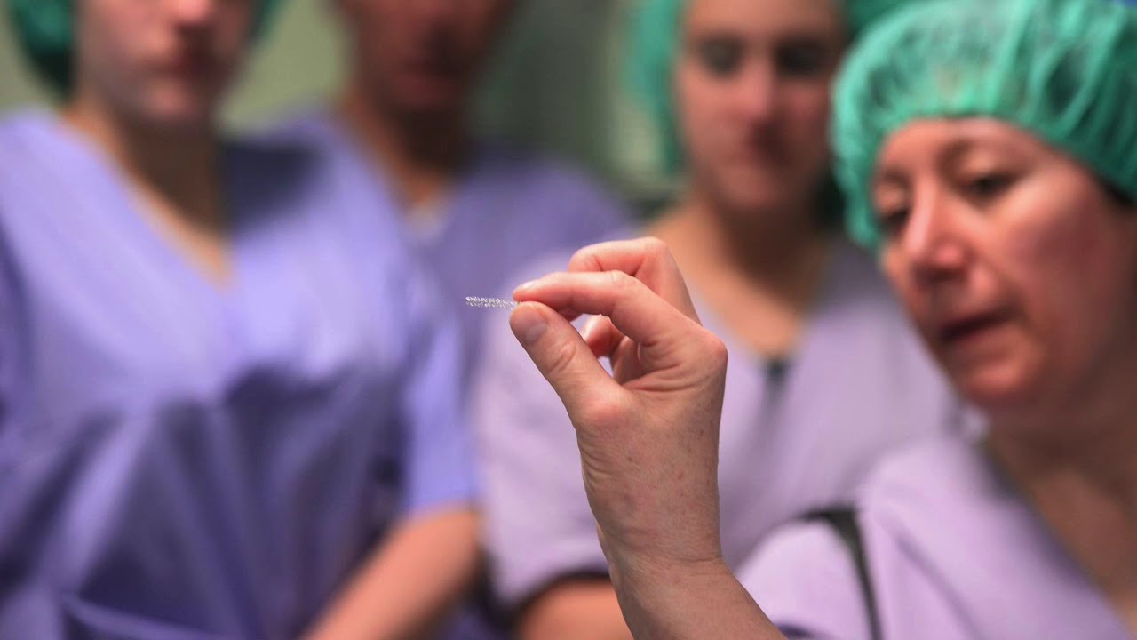 Stent coronarico - Cos'è e come funziona