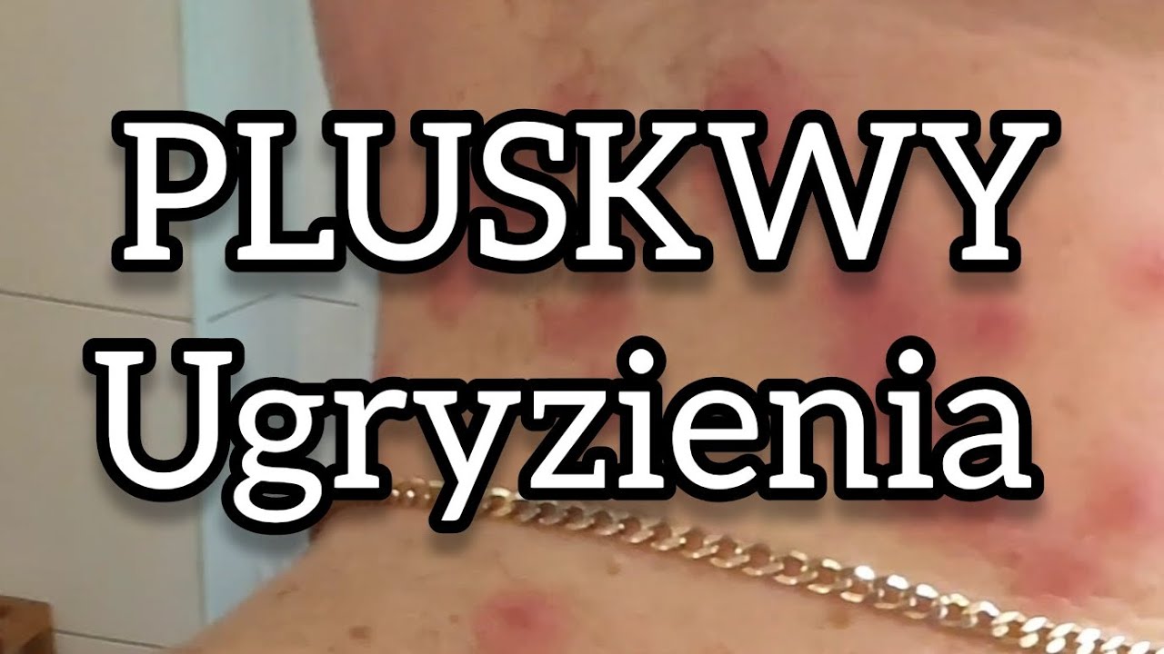 Jak wyglądają ugryzienia pluskiew? #pluskwy #zwalczaniepluskiew #lukaszbula