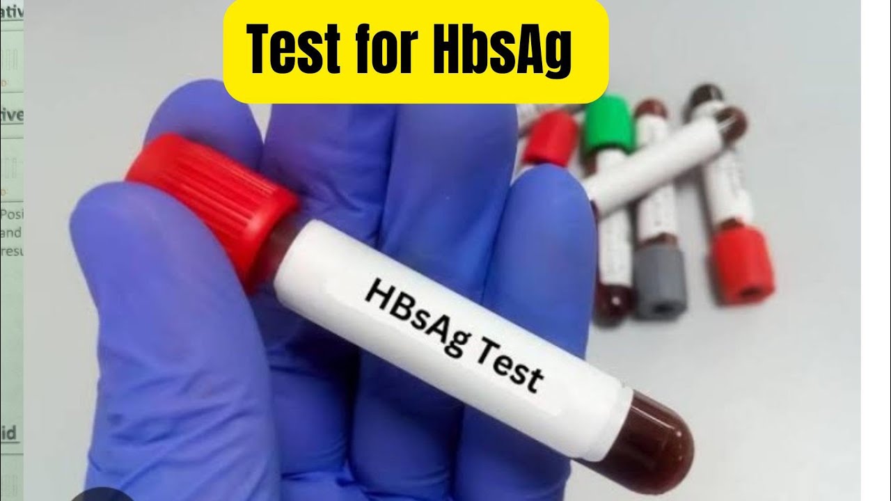 Test for Hbsag|| Hbsag in hindi|| donor screening test