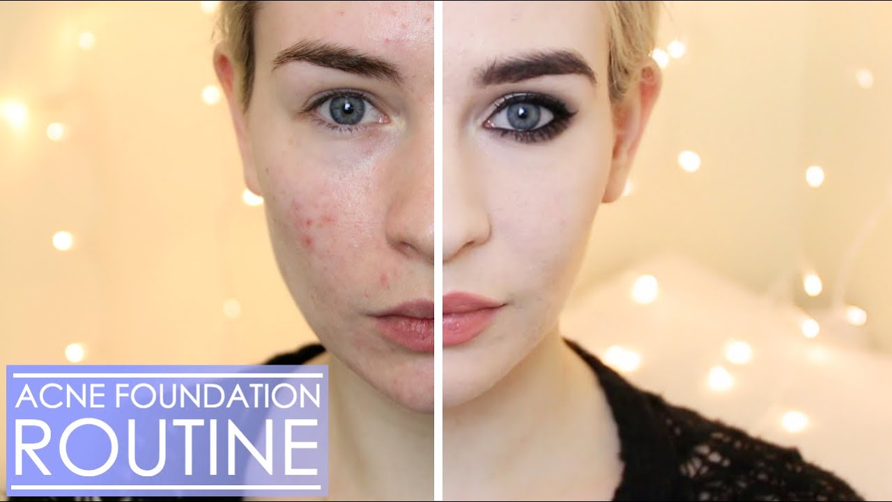 DRUGSTORE ACNE FOUNDATION ROUTINE