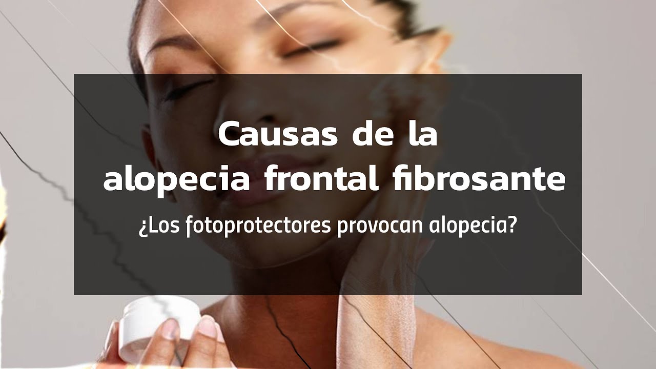 Causas de la alopecia frontal fibrosante ¿Los fotoprotectores provocan alopecia?