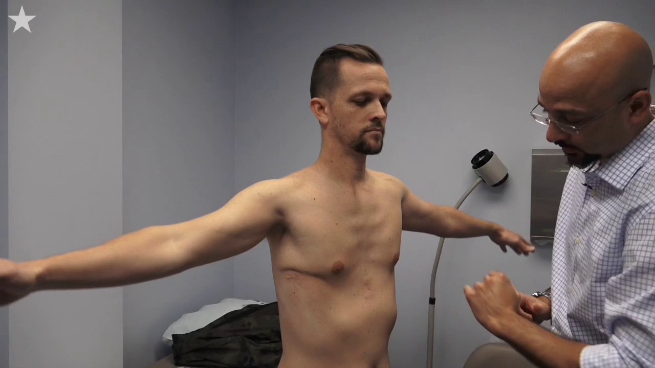 38-year-old's sunken chest repaired by pediatric surgeon