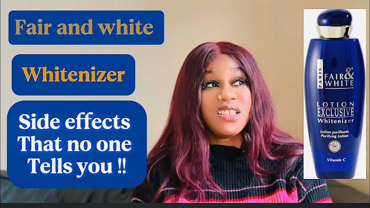 FAIR AND WHITE LOTION: THE SIDE EFFECT NO ONE TELLS YOU😱. Honest Review. #juditheffect #fairandwhite