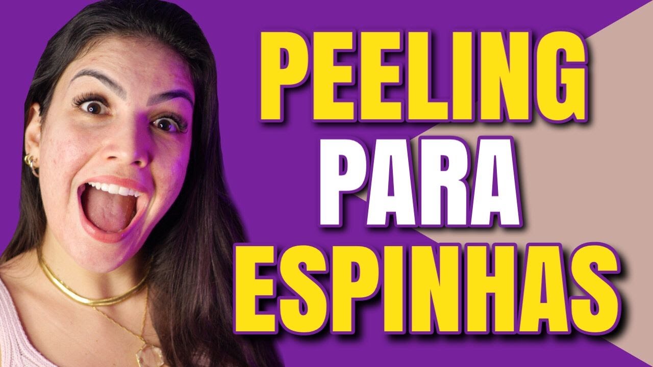 QUAL MELHOR PEELING PARA ESPINHAS [ACNE]?