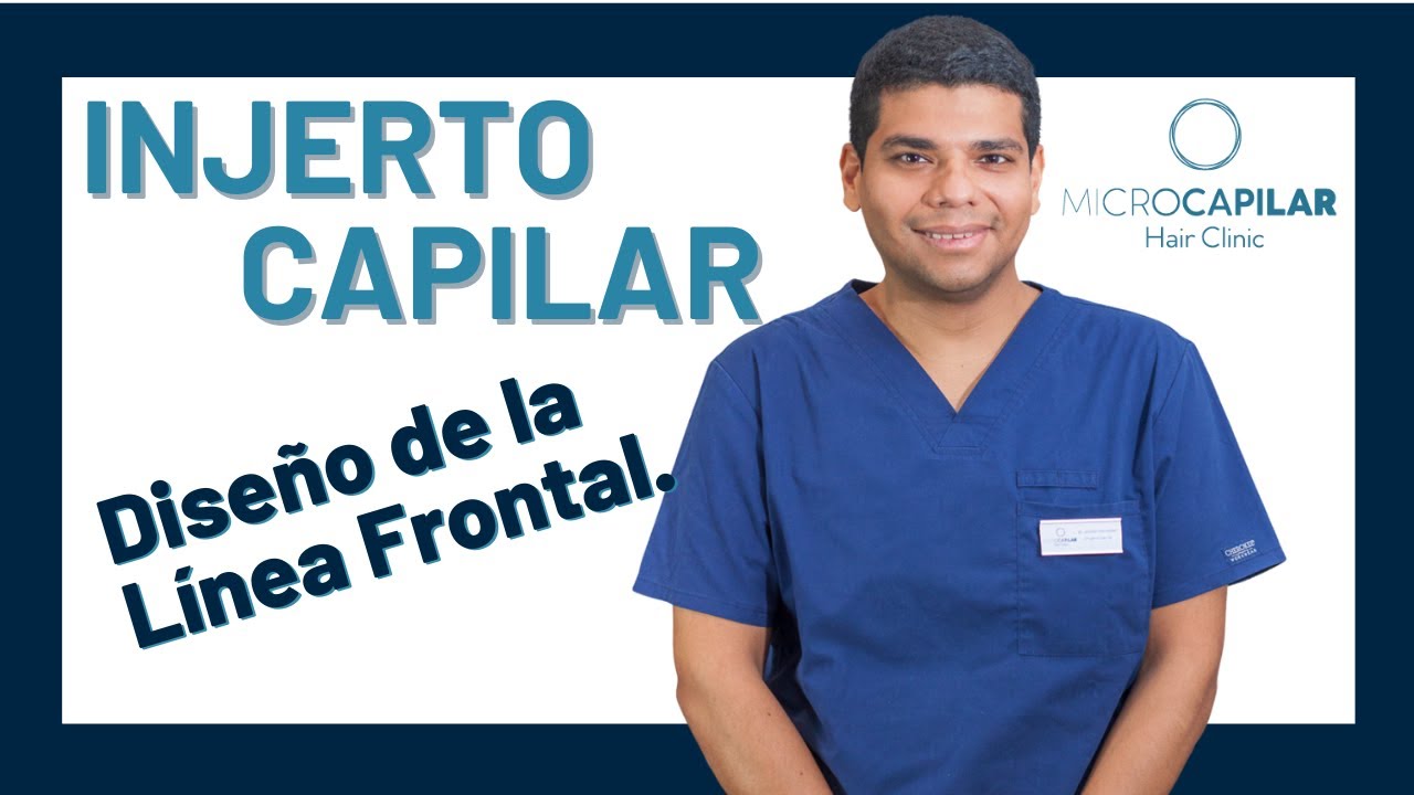 👨‍⚕️TODO lo que necesitas saber sobre el diseño de la LÍNEA FRONTAL en la cirugía de INJERTO CAPILAR
