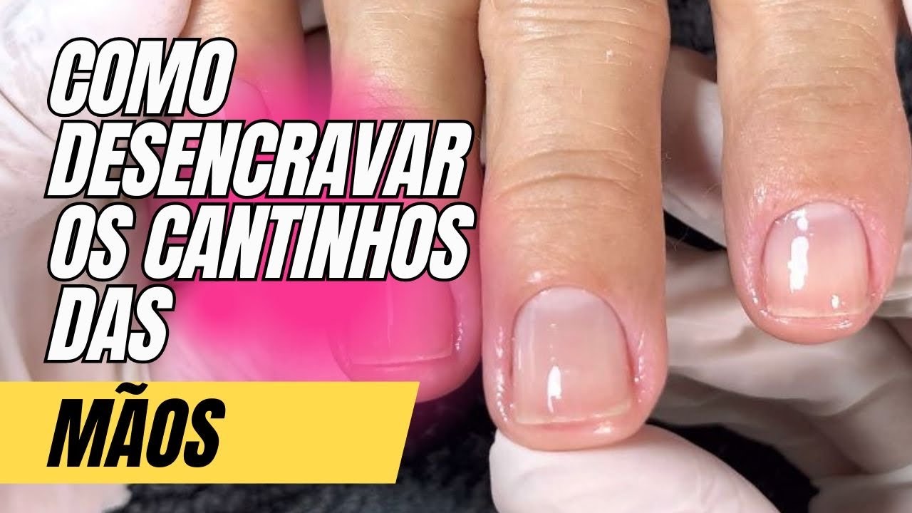 Como fazer a cutícula da mão e tirar os cantinhos encravados.Não perca essas dicas😉