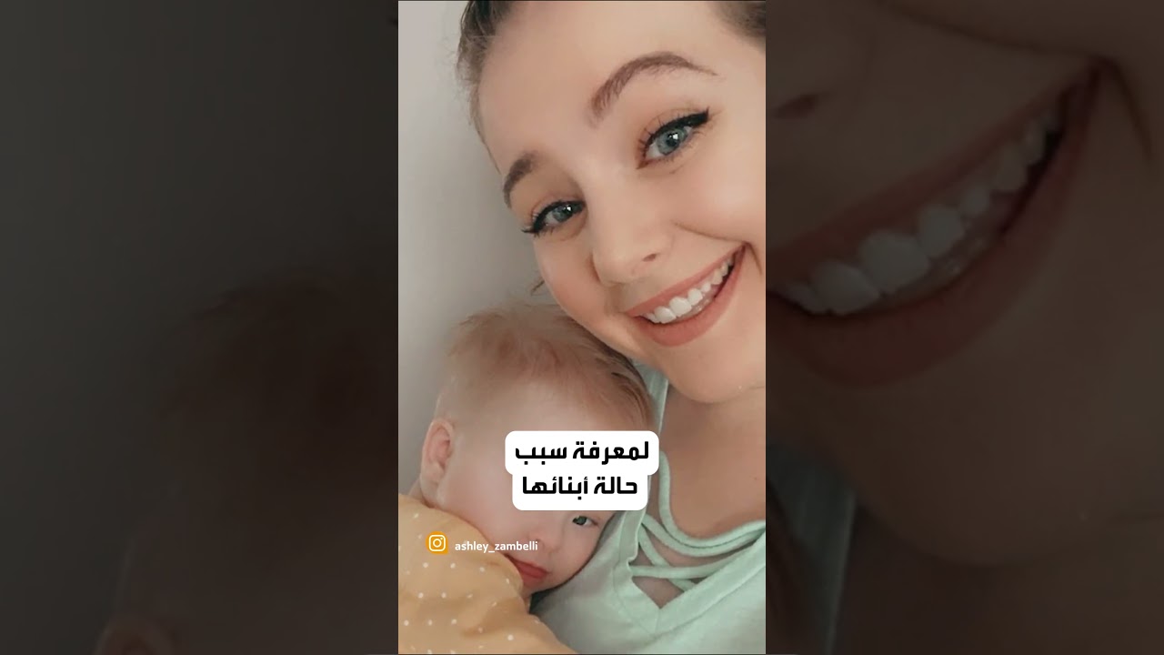 فتاة تكتشف إصابتها بمتلازمة 