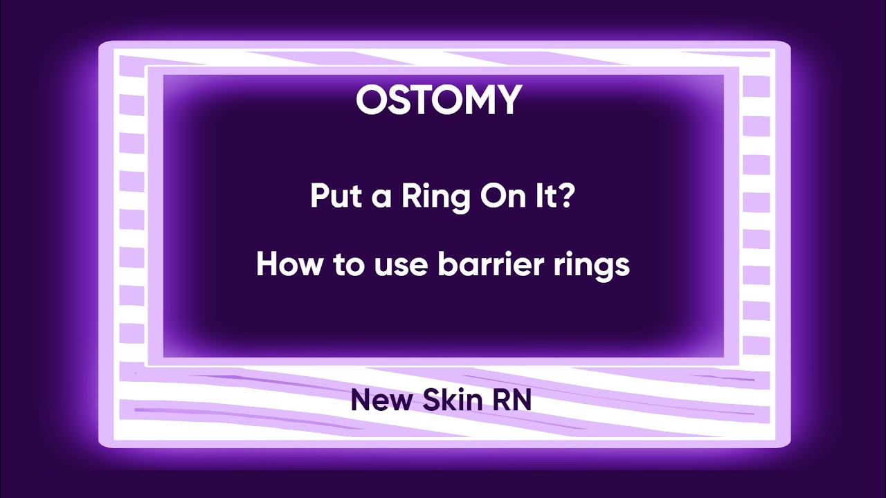 Put a Ring On It?