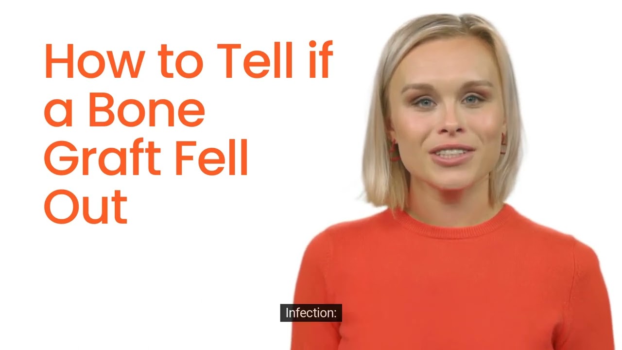 How to Tell if a Bone Graft Fell Out?