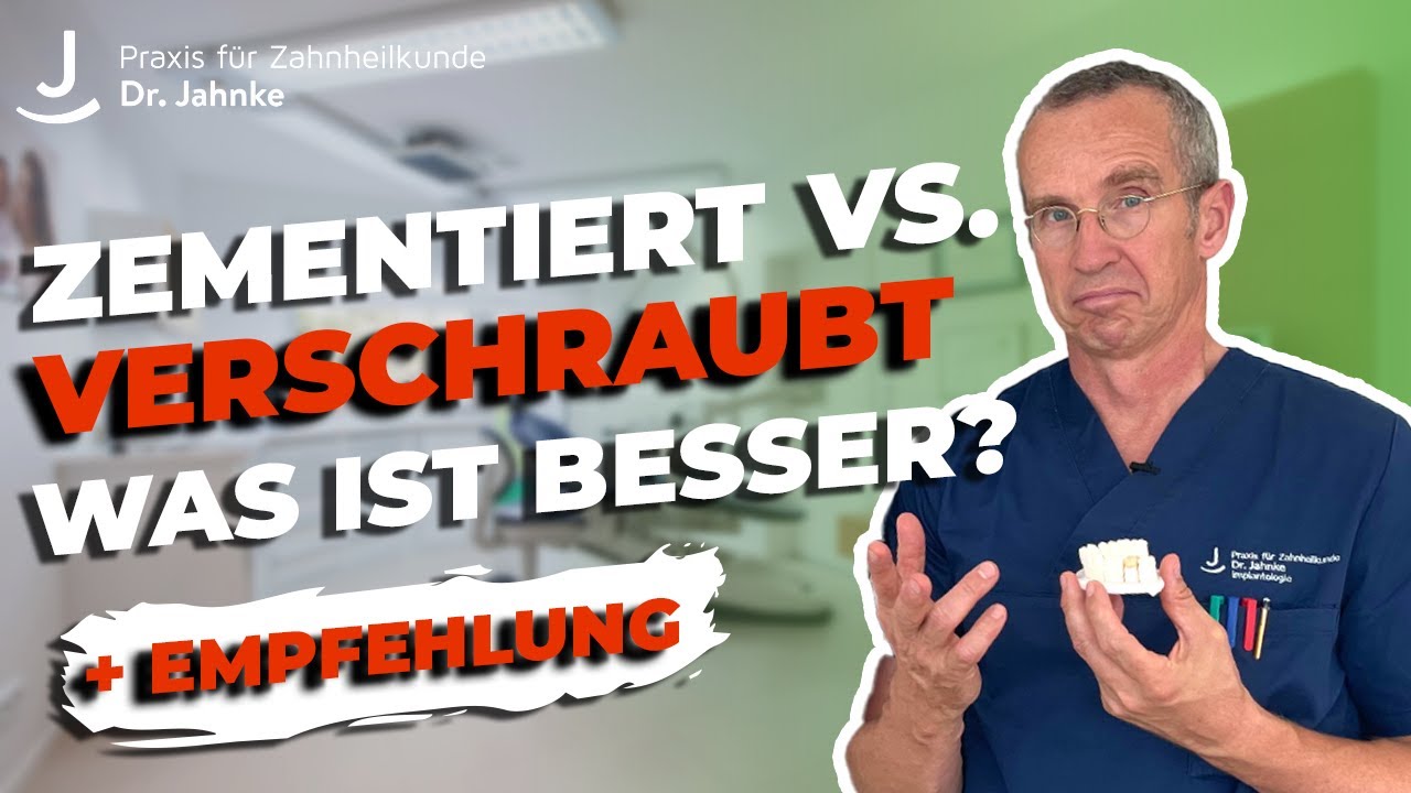 Wie werden Kronen auf Implantaten befestigt? Verschraubt VS. Zementiert