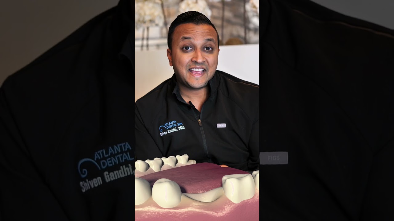 Dental Implant vs. Bridge | Which is the BEST option for you?