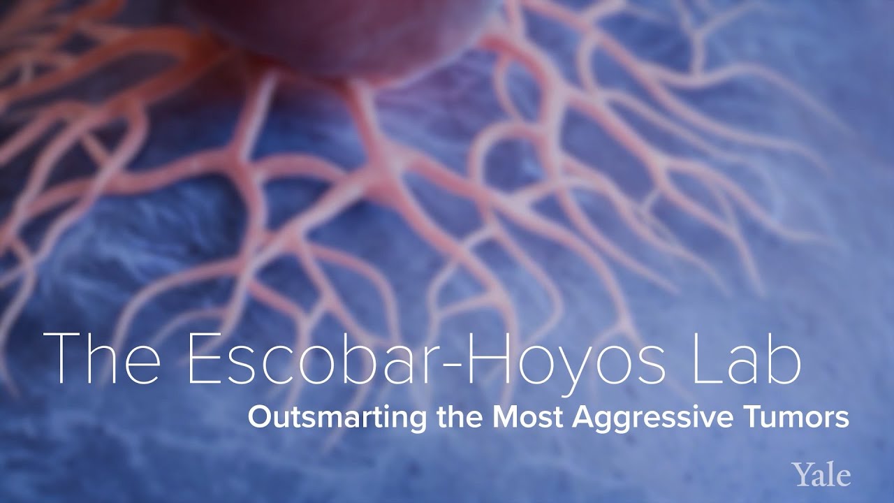 RNA Splicing, Pancreatic Cancer & Immuno-Oncology - The Escobar-Hoyos Lab at Yale School of Medicine