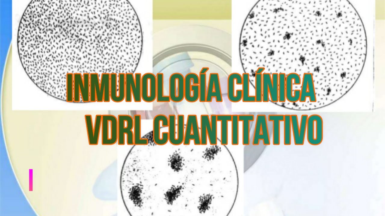 VDRL Cuantitativo