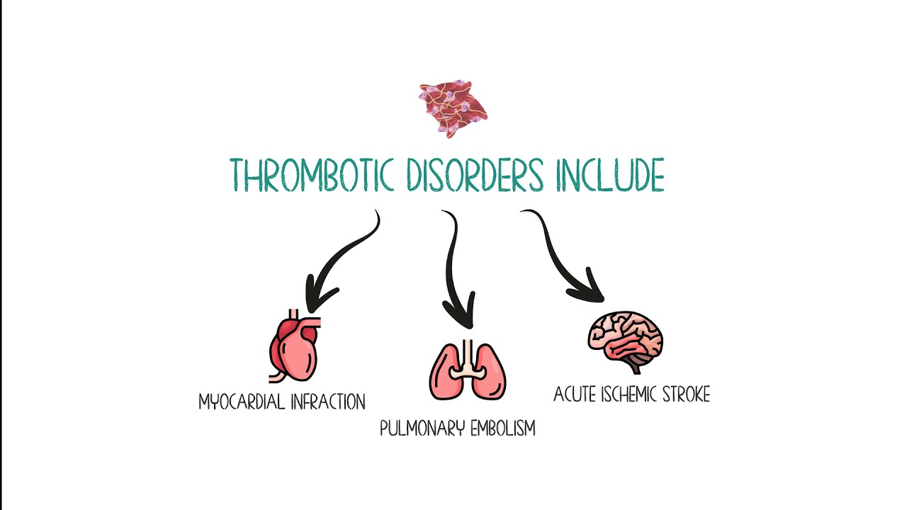 Antiplatelet, Anticoagulants, and thrombolytics