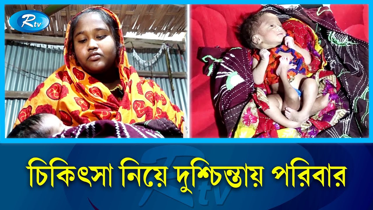 চার পা নিয়ে জন্ম নিলো কন্যা শিশু! | Chattogram | Rtv News
