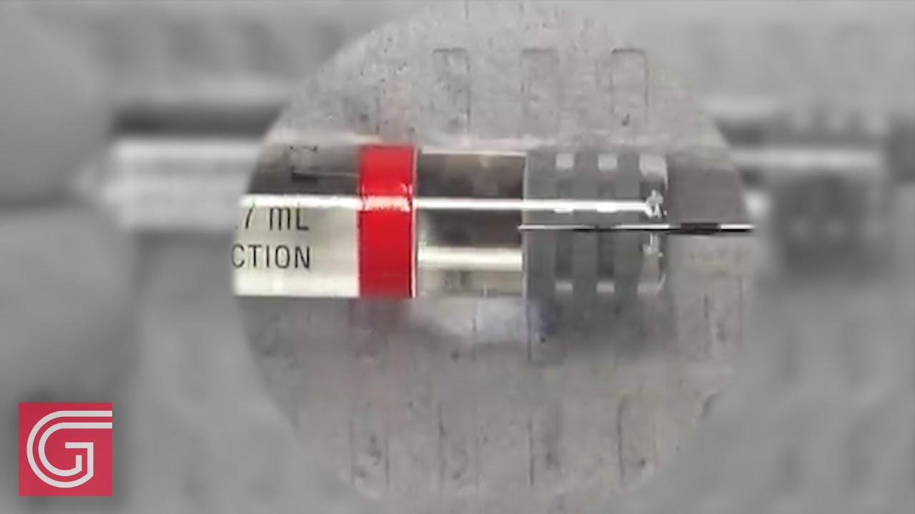 How to Reduce Injection Pain by Buffering Local Anesthesia