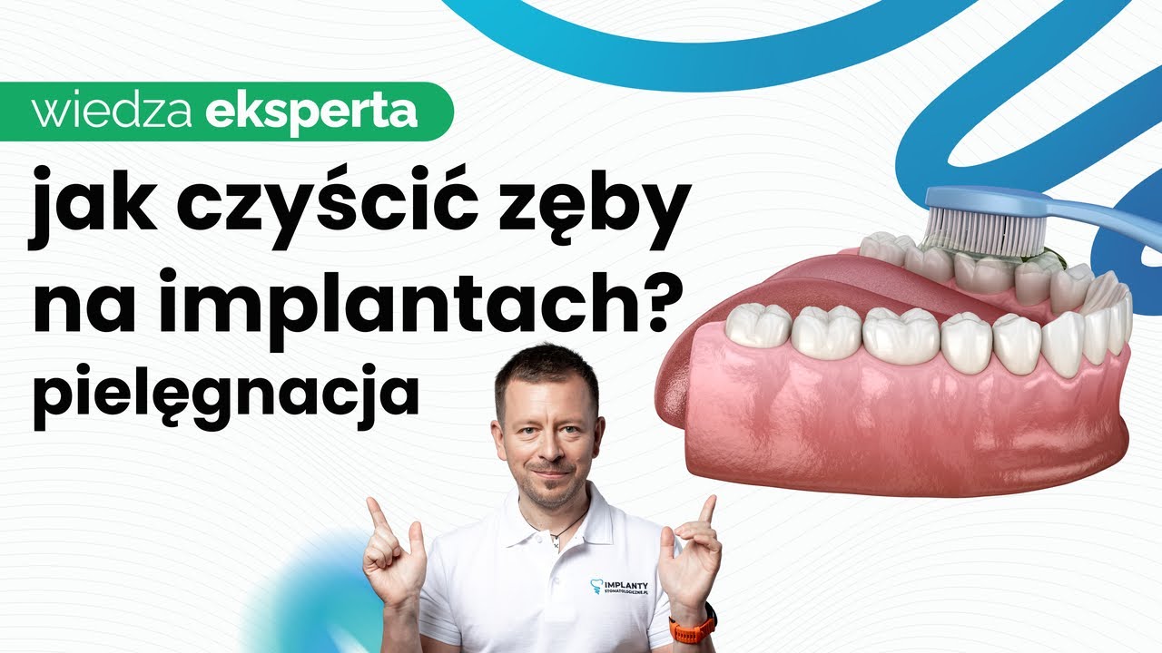 JAK DBAĆ O HIGIENĘ JAMY USTNEJ KIEDY POSIADASZ IMPLANTY? IRYGATOR