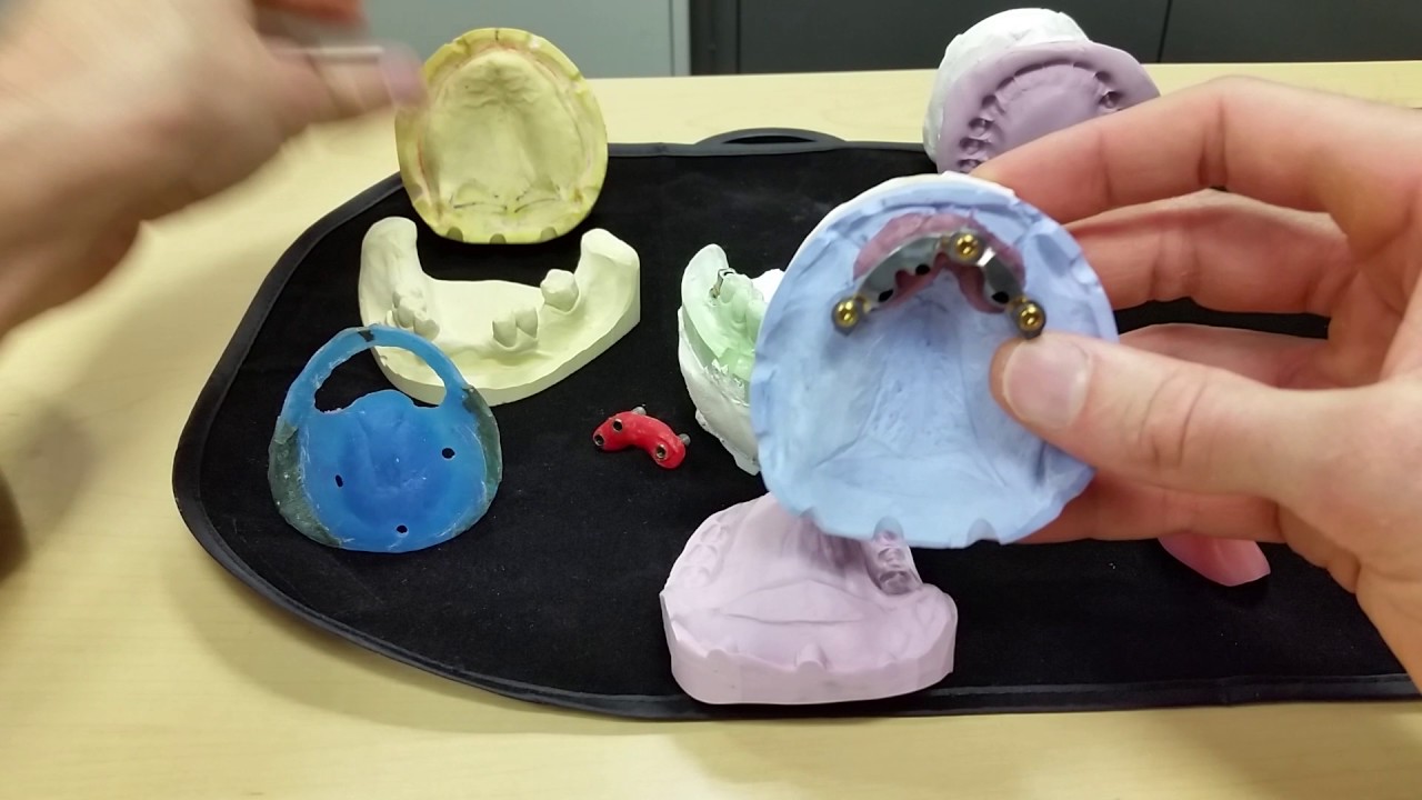🎉Ultimate guide for Bar Over Denture🎉 Dr.  Derek B.  Gatta