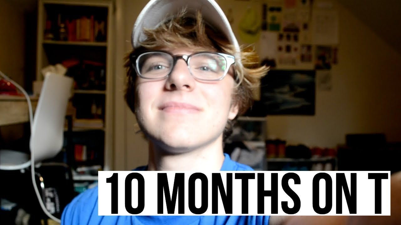 FTM TRANSGENDER: 10 MONTHS ON TESTOSTERONE