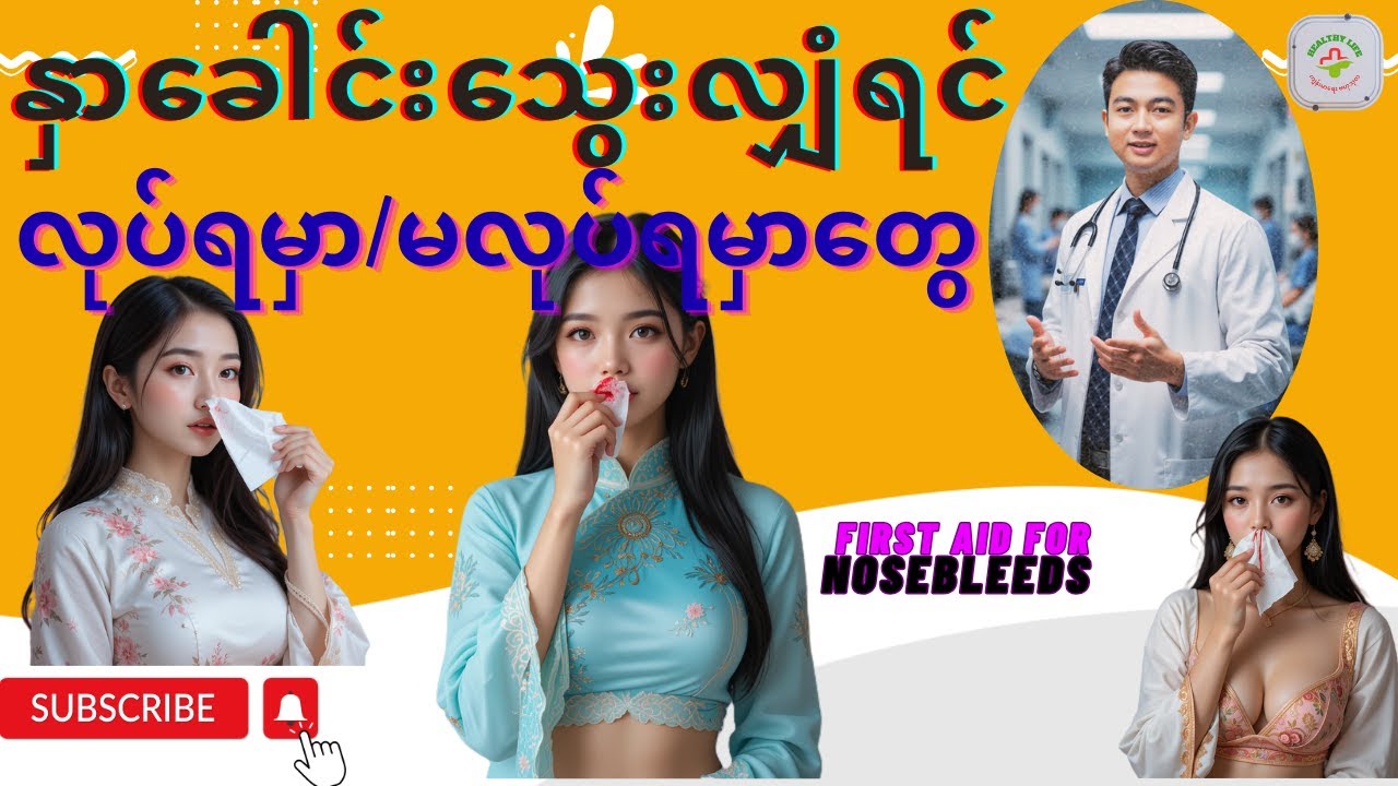 နှာခေါင်းသွေးလျှံရင် မမှားကြလေအောင် | First Aid for Nosebleeds ( Nose Bleeding )
