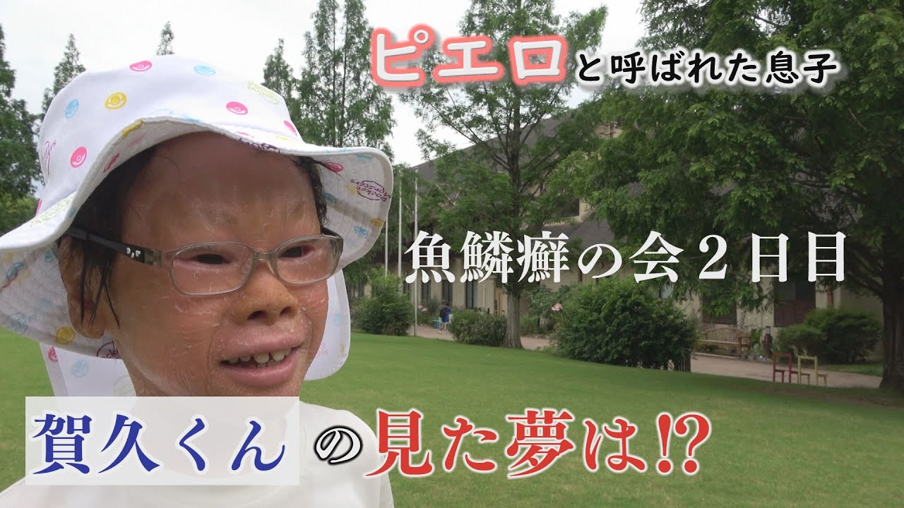 魚鱗癬の会でピアノ演奏♪「がんばろう。がく」テーマソング～配信型ドキュメンタリー「ピエロと呼ばれた息子」第１３７話