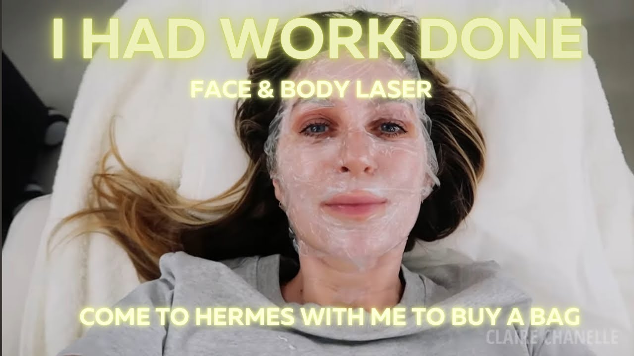 I HAD WORK DONE ON MY FACE & BODY. SHOWING YOU EVERYTHING! COME TO HERMES TO BUY A BAG