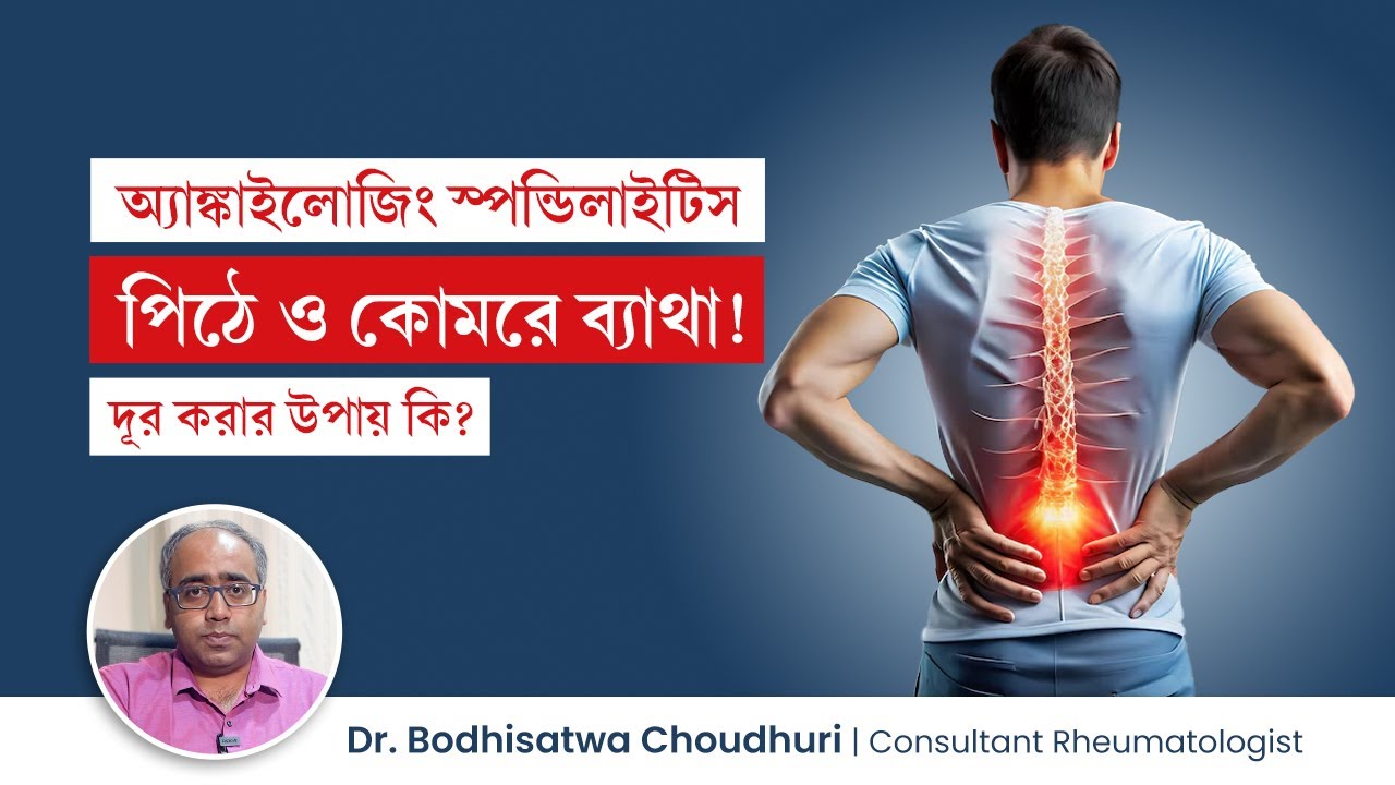 অ্যাঙ্কাইলোজিং স্পন্ডিলাইটিস কেন হয়? পিঠে ও কোমরে ব্যাথা দূর করার উপায় | Ankylosing spondylitis