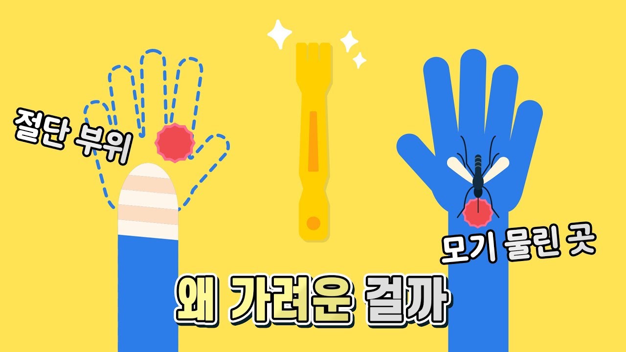 가려움이 생기는 이유 그리고 환상통