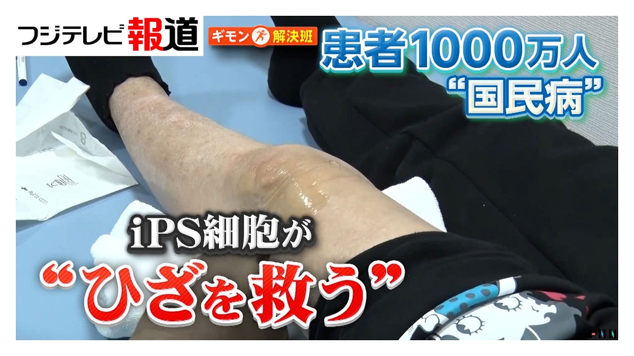 iPS細胞が1000万人の“ひざを救う”？“世界初”人工軟骨の新技術…安全面・生産コストが課題（2026年03月13日）
